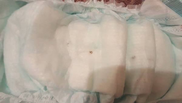 WARNING. Razor sharp metal shards found in Pampers nappies