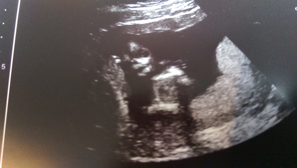 February '16 approaching and conquering the 12 week mark!