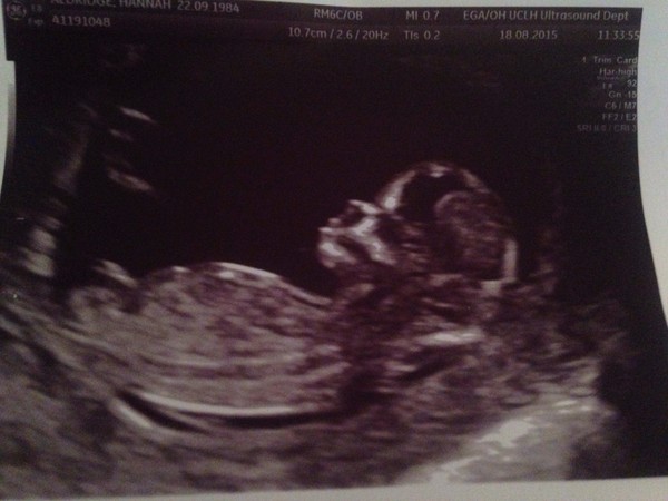 February '16 approaching and conquering the 12 week mark!