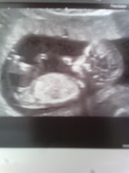 February '16 approaching and conquering the 12 week mark!