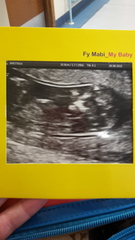 Nub guesses??? Boy or girl??? Xx