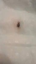 WARNING. Razor sharp metal shards found in Pampers nappies