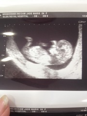 Jan 2016 #8 Enjoying second trimester and 20 week scans