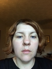 Further barnet assistance (pics...ugh)