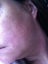 Look at my bad skin - what can i use to improve?