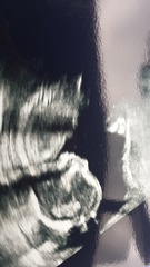 Jan 2016 #8 Enjoying second trimester and 20 week scans