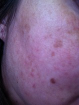 Look at my bad skin - what can i use to improve?