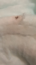 WARNING. Razor sharp metal shards found in Pampers nappies