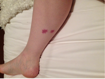 February 2016 - Boobs are growing, sickness is going, and some of us are finally showing!!