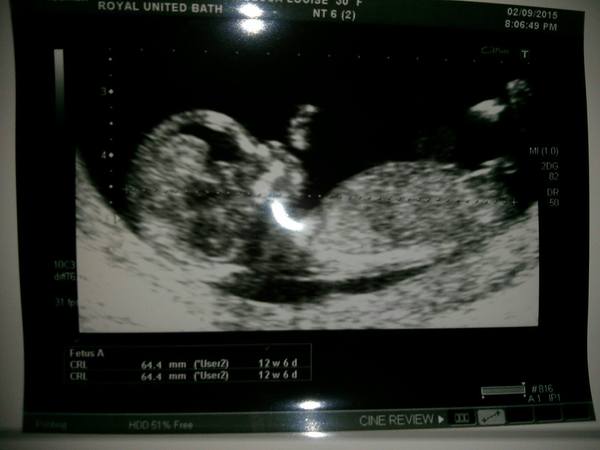 March 2016 #4 - entering the second trimester at last and (hopefully) waving goodbye to sickness