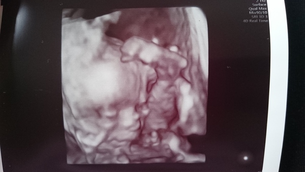 Whilst the rest of us chowed down on runny eggs and shellfish, deeply sneezed out a baby!...It's superb scans all around and only the occasional nose-vom on JS Grads 38!