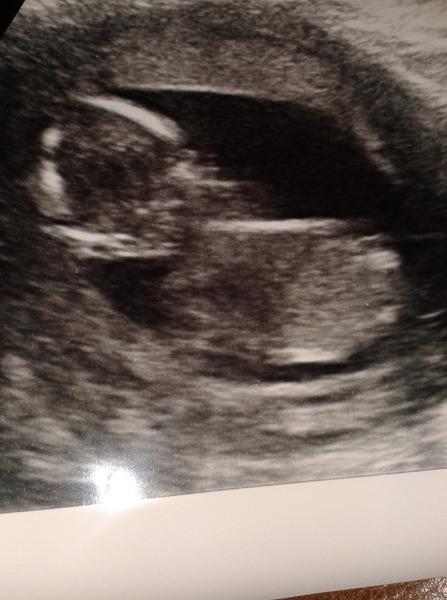 March 2016 #4 - entering the second trimester at last and (hopefully) waving goodbye to sickness