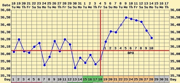 Short Luteal Phase