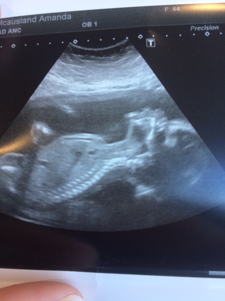 February 2016 - Boobs are growing, sickness is going, and some of us are finally showing!!