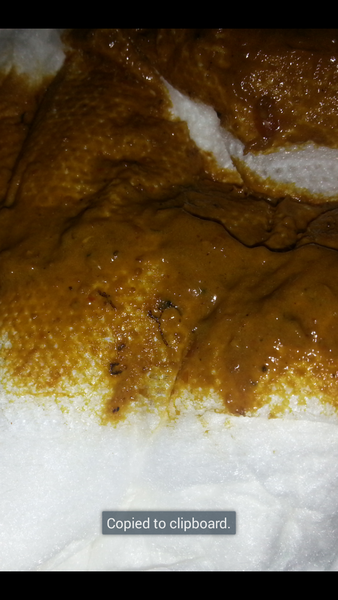 taadaa shiny new gastrostomy support thread no.3 tube feeding support