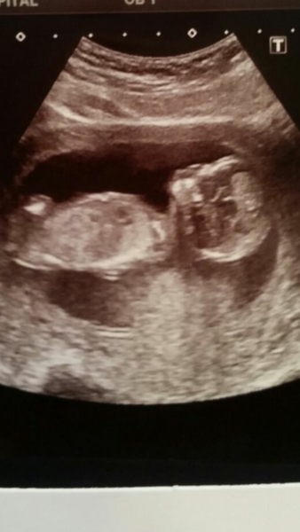 March 2016 #4 - entering the second trimester at last and (hopefully) waving goodbye to sickness