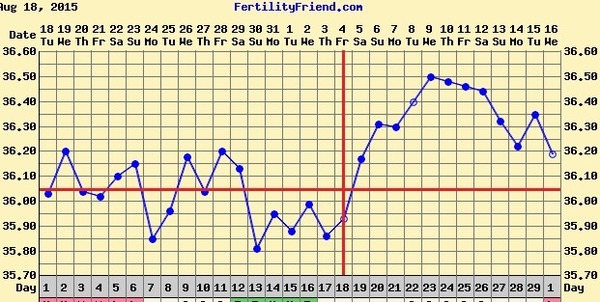 Short Luteal Phase