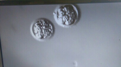 Strapping on our lady balls and going menkul because we HATE THIS SHIT!! The Berries: a lovely bunch of 30 something Ladybros TTC #1