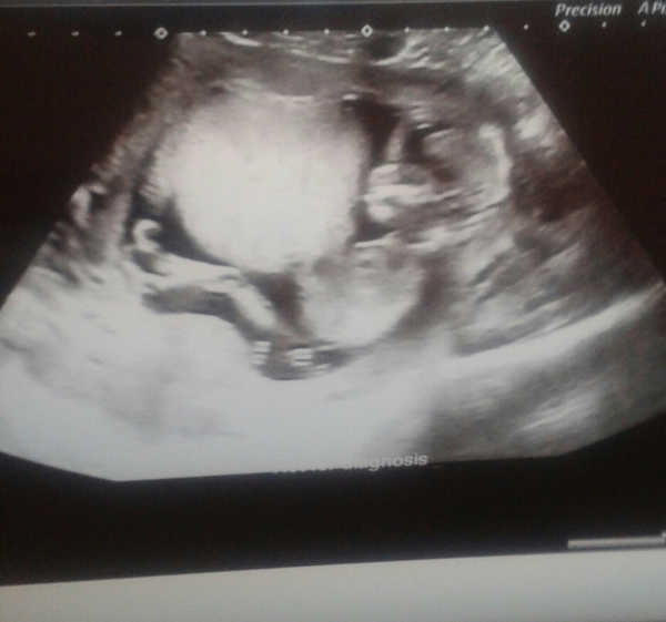 March 2016 #4 - entering the second trimester at last and (hopefully) waving goodbye to sickness