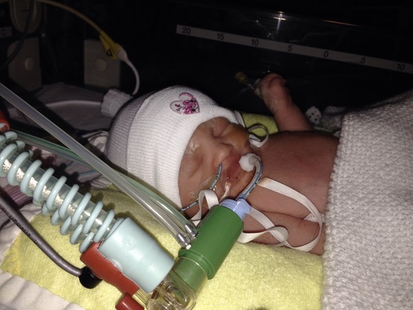 Continuing a Pregnancy with a lethal diagnosis