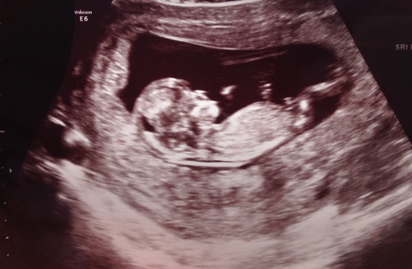 March 2016 #4 - entering the second trimester at last and (hopefully) waving goodbye to sickness