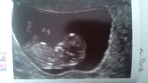 March 2016 #4 - entering the second trimester at last and (hopefully) waving goodbye to sickness