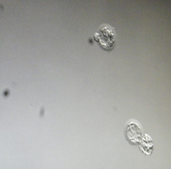 Strapping on our lady balls and going menkul because we HATE THIS SHIT!! The Berries: a lovely bunch of 30 something Ladybros TTC #1