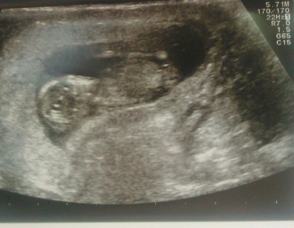 Care to guess the gender?
