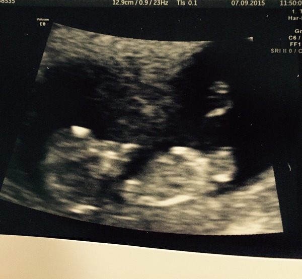 March 2016 #4 - entering the second trimester at last and (hopefully) waving goodbye to sickness