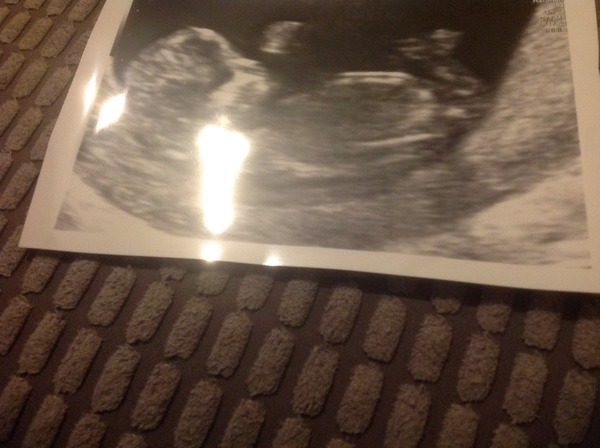 March 2016 #4 - entering the second trimester at last and (hopefully) waving goodbye to sickness