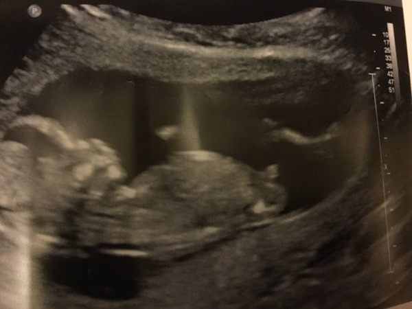 March 2016 #4 - entering the second trimester at last and (hopefully) waving goodbye to sickness
