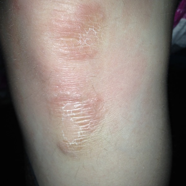 What the chuff is this? (With pic - skin related)