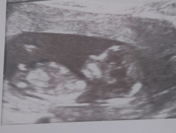 April 2016 babies. Nausea, bloating and wind - feeling HOT!