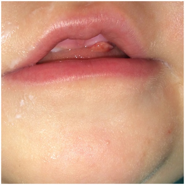 Teething - is this normal?