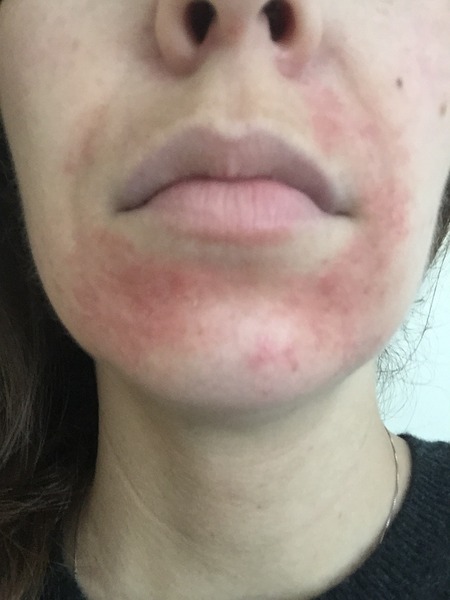 February 2016 - Boobs are growing, sickness is going, and some of us are finally showing!!