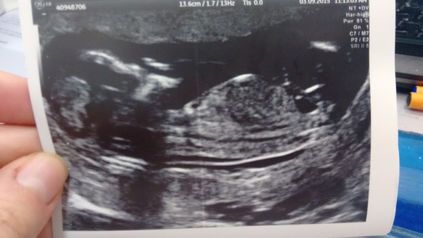 March 2016 #4 - entering the second trimester at last and (hopefully) waving goodbye to sickness