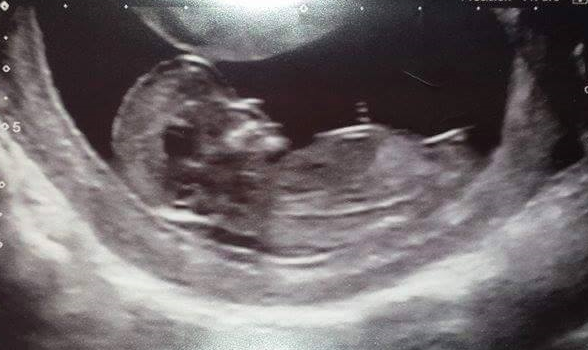 March 2016 #4 - entering the second trimester at last and (hopefully) waving goodbye to sickness