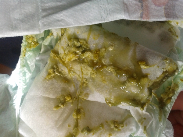 Scrambled egg texture in 9wk old's nappy?? (pic included)