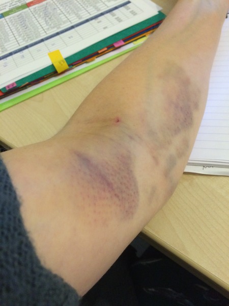 40+ and pregnant? Come and join the fun!