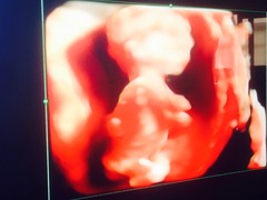 13 week gender predictions please!