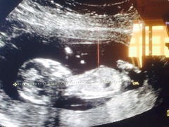 13 week gender predictions please!