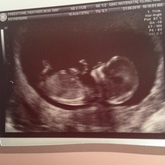 Boy or girl?