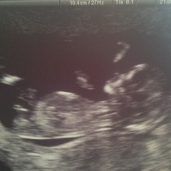 Boy or girl?