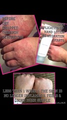 MLM-bot watch -  FL, Juice Plus, Younique etc