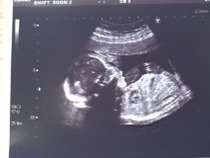 Gender guesses. Skull and nub theory.
