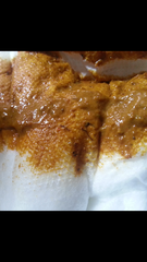 taadaa shiny new gastrostomy support thread no.3 tube feeding support