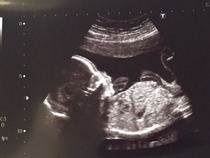Gender guesses. Skull and nub theory.