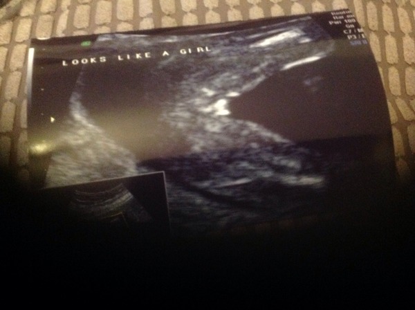 Had our private gender scan today