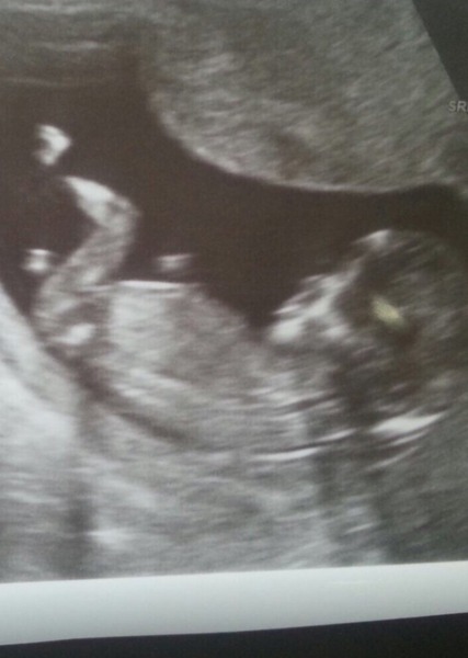 Boy or girl? Any ideas :)