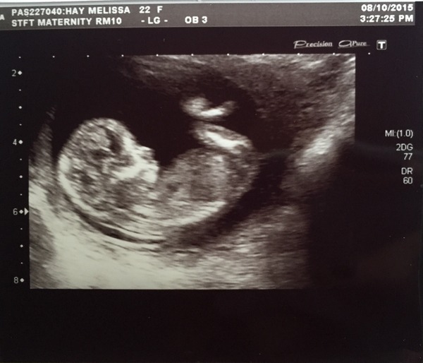 Boy or girl?
